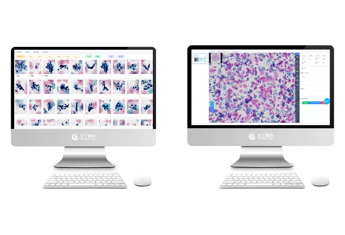 Cloud AI Cervical Cytology Solution