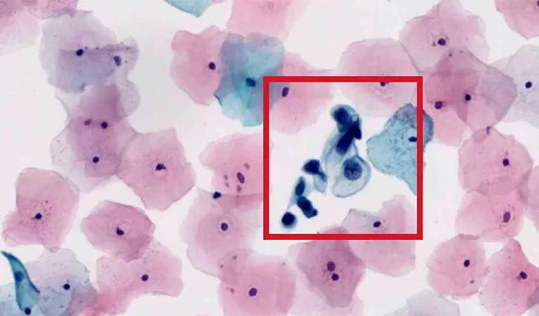 /products/on-premise-ai-cervical-cytology-solution/